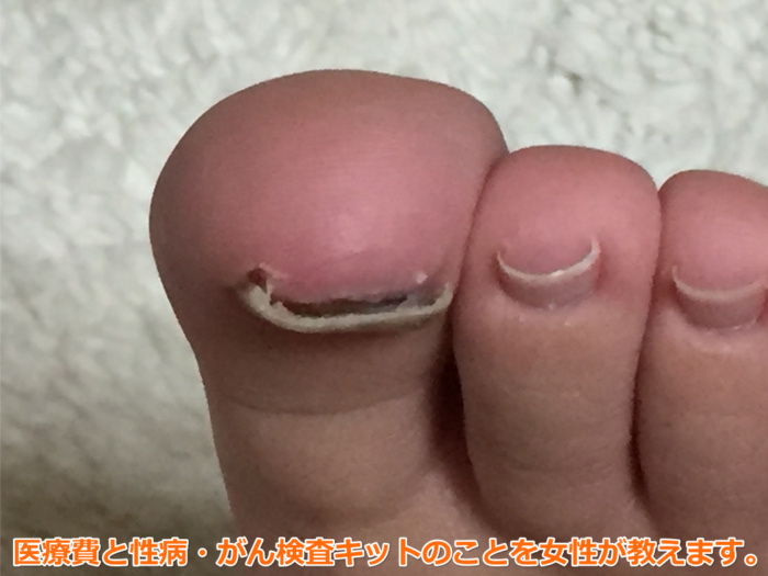 足の爪が剥がれた。病院に行くとしたら診療科は何科？